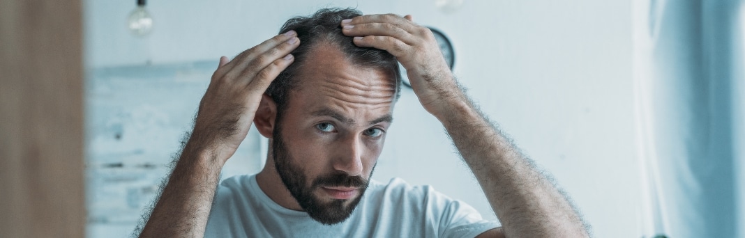 Hair loss Frisco TX