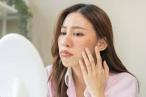 A woman with melasma looking in the mirror and considering IPL